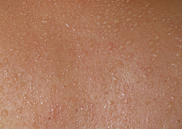 Menselijke huid en zweet - Foto, afbeelding
