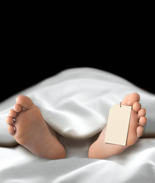 Тело мертвого человека лежит в морге
 - Фото, изображение