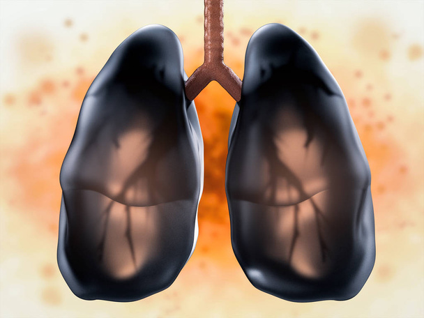 чорний хворі легені
 - Фото, зображення