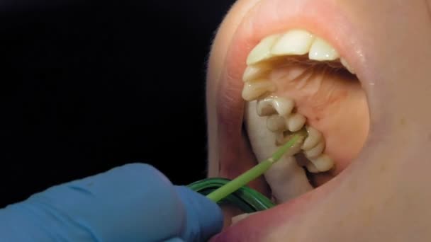 Kadın tedavi için diş hekimi tıbbi klinikte - Video, Çekim