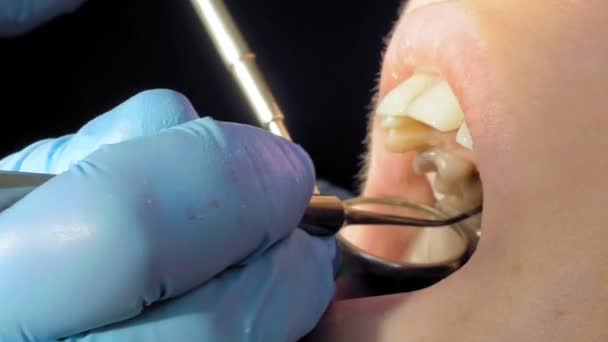 Kobieta w klinice medycznej dentysta dla leczenia - Materiał filmowy, wideo