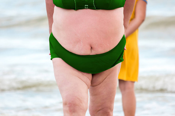 Stomach of a fat woman. - Photo, Image