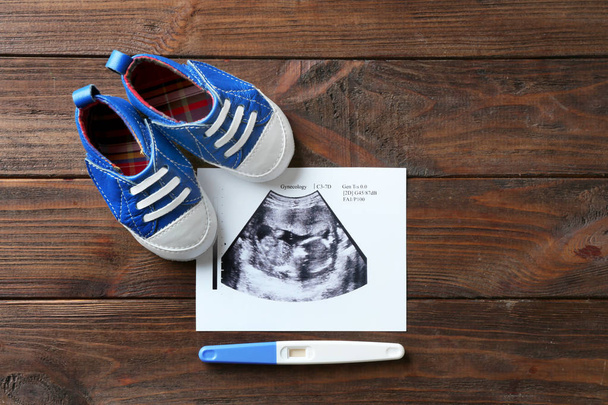 Ultrasound picture of baby - Fotografie, Obrázek