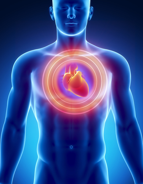 Концепція серцевий напад
 - Фото, зображення