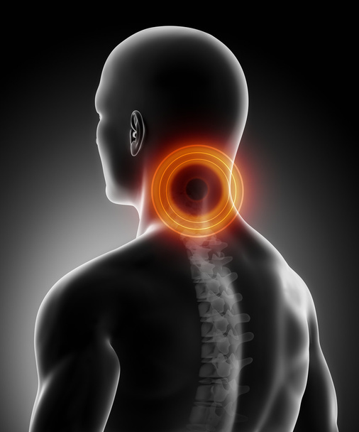 頚部脊柱の解剖学の痛み - 写真・画像