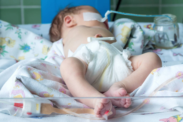 Orogastric チューブとパルス酸素濃度計のセンサーと生まれたばかりの赤ちゃん - 写真・画像