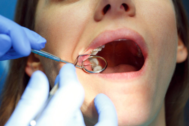 Woman getting a dental treatment - Foto, afbeelding