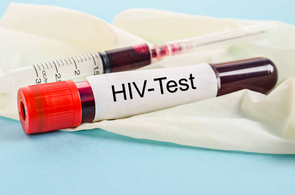 Sample blood for screening test for HIV test. - Zdjęcie, obraz