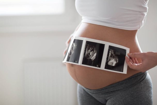 Pregnant woman expecting newborn - Фото, изображение