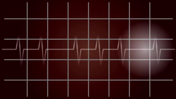 Diagnoza EKG, pulsujące, puls ruchu, wideo - Materiał filmowy, wideo