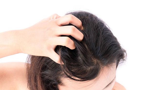 Zbliżenie kobieta ręka swędzenie skóry głowy, koncepcja Pielęgnacja włosów - Zdjęcie, obraz