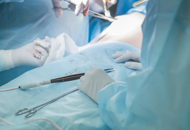 Surgeon putting on stitches during cosmetic surgery in hospital  - Valokuva, kuva