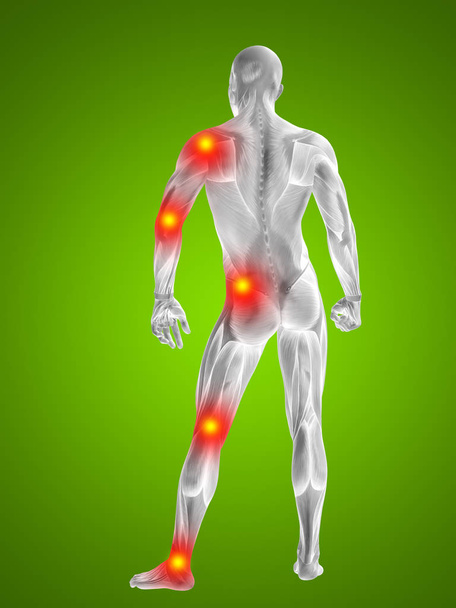 человеческие мышцы с болью в суставах или костях
 - Фото, изображение