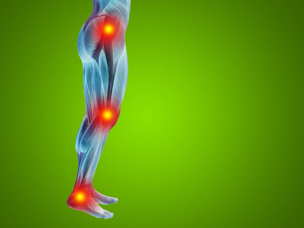 músculos humanos com dor articular ou óssea
 - Foto, Imagem