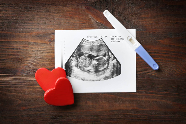 Ultrasound picture of baby - Photo, image
