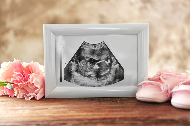Ultrasound picture of baby - Fotó, kép