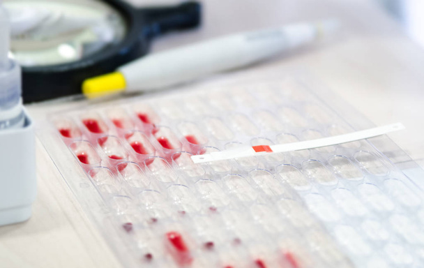Litmus strips for blood analysis on pallets with the blood to determine the Rh factor. - Photo, image