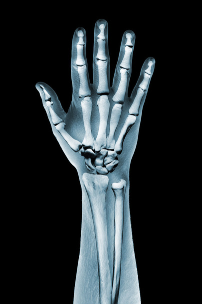 драматизированный рентгеновский луч руки на черном
 - Фото, изображение