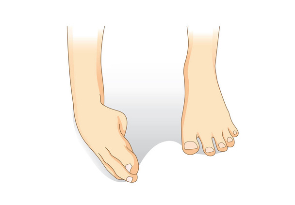 Ankle sprain while walking. - Вектор,изображение
