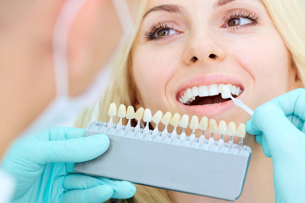 Closeup of a girl with beautiful smile at the dentist. Dental - Valokuva, kuva