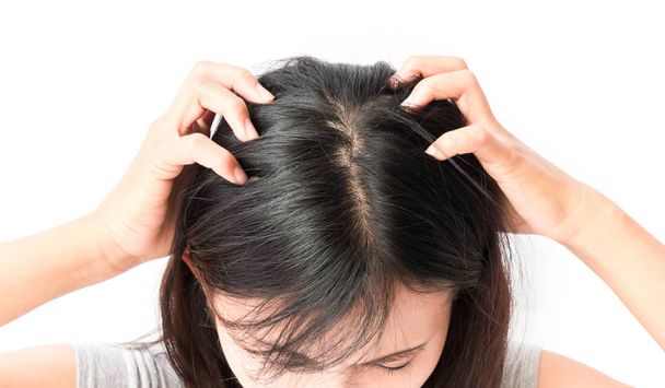 Closeup mulher mão coceira couro cabeludo, conceito de cuidados com o cabelo
 - Foto, Imagem