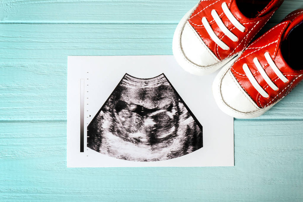 Ultrasound baby scan - Foto, afbeelding