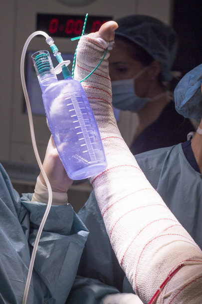 Bandage nach Knie-Operation - Foto, Bild