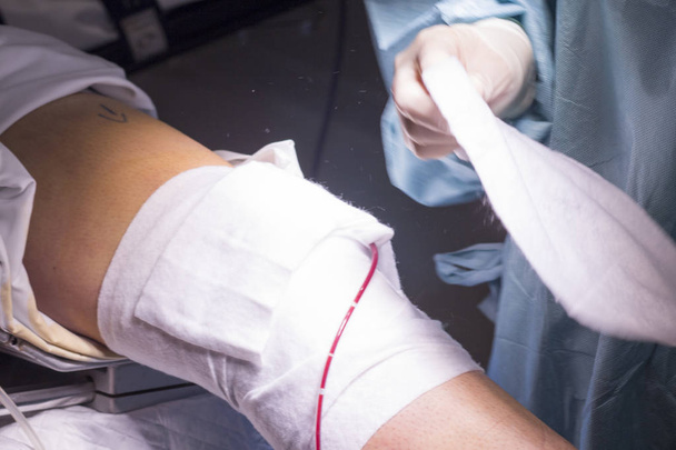 Bandaging post knee surgery - Foto, immagini