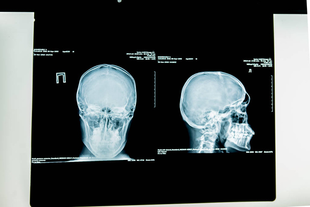 Immagine a raggi X dell'uomo
 - Foto, immagini