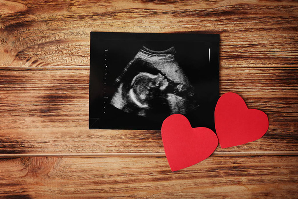Ultrasound baby scan - 写真・画像