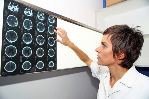 CT (tomodensitométrie) de l'endocranium, CT de la tête
  - Photo, image