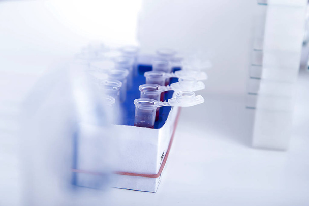 Micro tubes with  Blood sample positive with Zika virus - Φωτογραφία, εικόνα