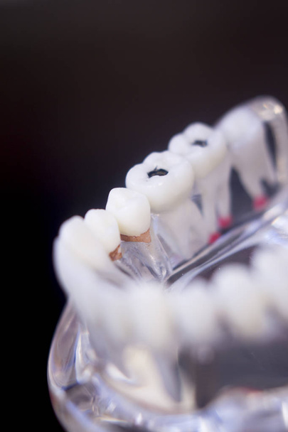 Tandartsen tandheelkundige tanden model - Foto, afbeelding