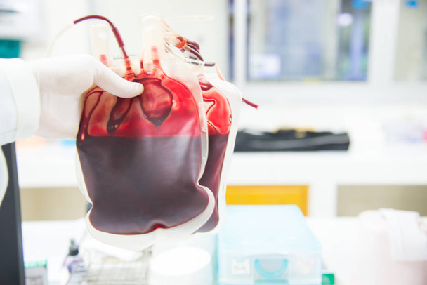 赤い血袋手に科学者 laborat の白い背景の上 - 写真・画像