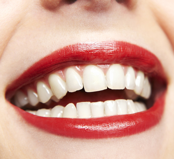 Healthy woman teeth and smile. Close up. - Foto, Bild