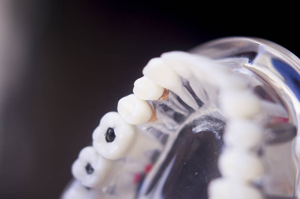 Dentistas modelo de dentes dentários
 - Foto, Imagem