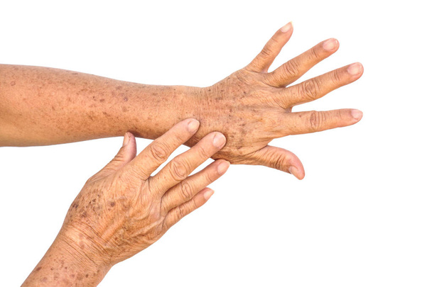 Weibliche Hände voller Sommersprossen - Foto, Bild