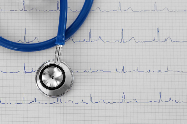 Electrocardiogram in paper form and stethoscope - 写真・画像