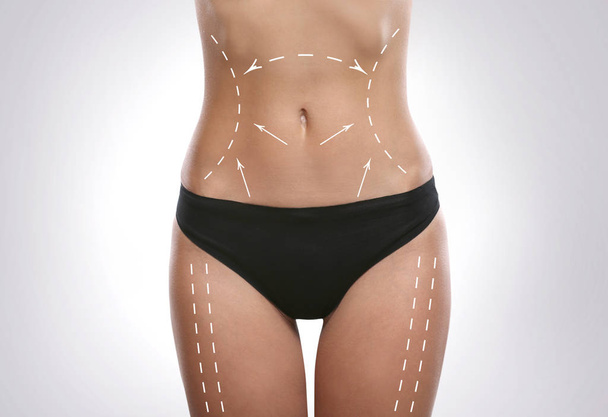 Plastic surgery concept - Foto, afbeelding