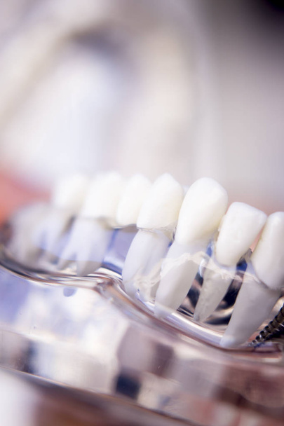Zubaři zubní zuby model - Fotografie, Obrázek