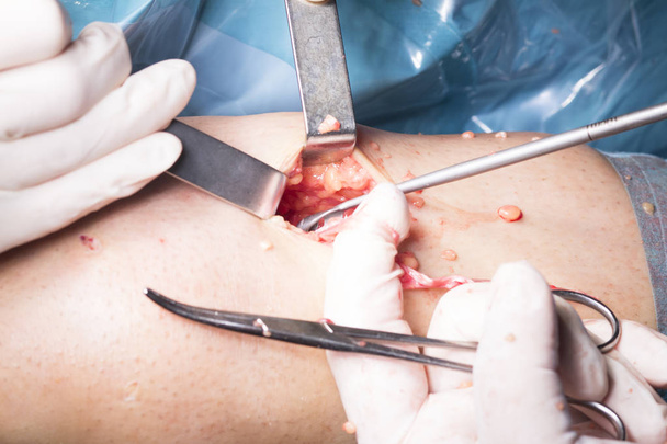 Surgical operation knee surgery - Φωτογραφία, εικόνα