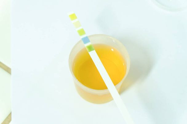 Amostra de urina para análise laboratorial
 - Foto, Imagem