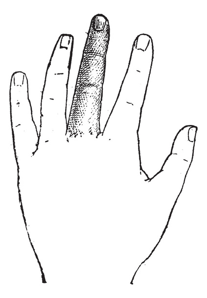 Людського середнім пальцем, vintage гравіювання - Вектор, зображення