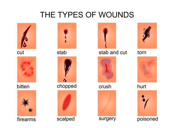 傷の種類 - ベクター画像