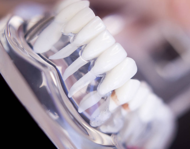 Dentysta dentystyczny zęby modelu - Zdjęcie, obraz