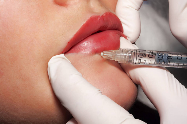 Doctor dermatologist performs Contour plastic: Injection of filler - Photo, Image