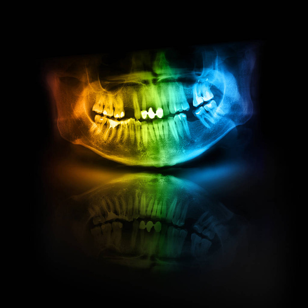Colore Dente della mascella del cranio a raggi X
 - Foto, immagini
