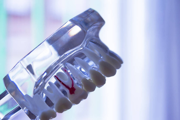 Hammasproteesi opiskelijoille läpinäkyvä
 - Valokuva, kuva