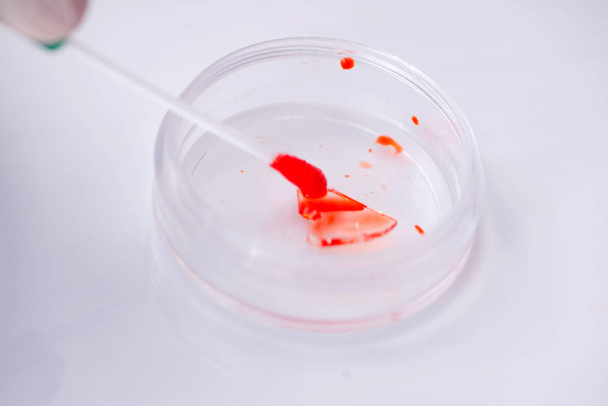 Blood testing in the lab - Φωτογραφία, εικόνα