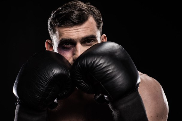Boxer met zwart oog - Foto, afbeelding